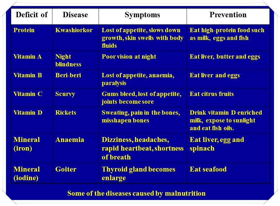 Health Problems Due To Bad Nutrition Intake Chapter 2 Form 5 Science Health Problems Due To Bad Nutrition Intake Chapter 2 Form 5 Science