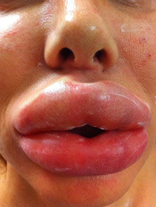 Dangers Of Mixing Methamph Tamine And Tanning Bed Dangers Of Mixing Methamph Tamine And Tanning Bed