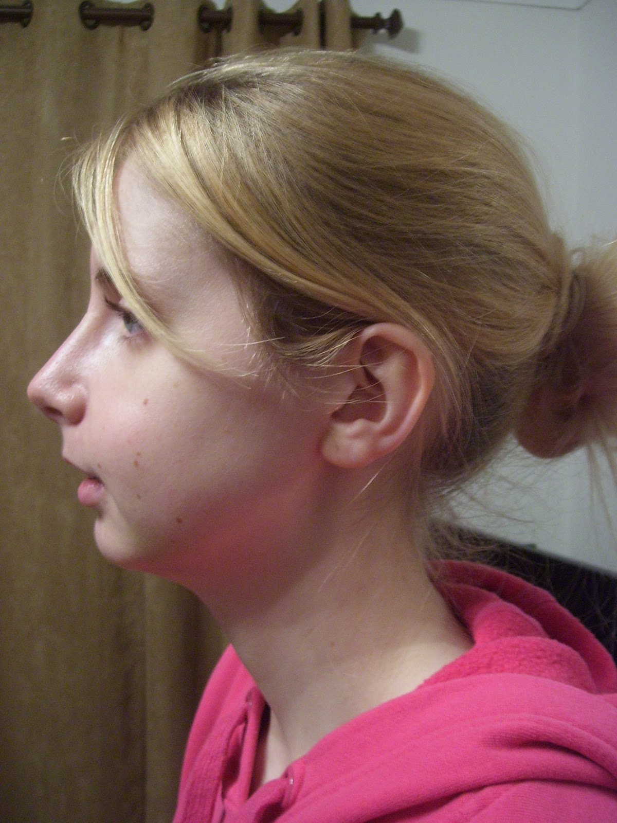 side profile jaw nice ugly surgery need hair story