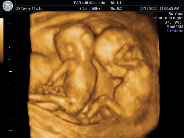 muñeco bebe que habla