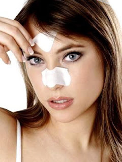 Blackheads