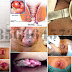 Jual Obat Wasir Yang Ampuh dan Tidak Mahal thumbnail