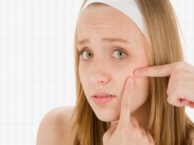 Tratamiento Natural Para Curar El Acne Tratamiento Natural Para Curar El Acne