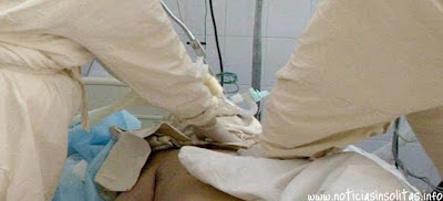 Casi pierde el pene por meterlo en una tubería de acero