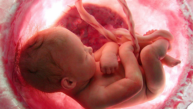 Sim à Vida, Não ao Aborto