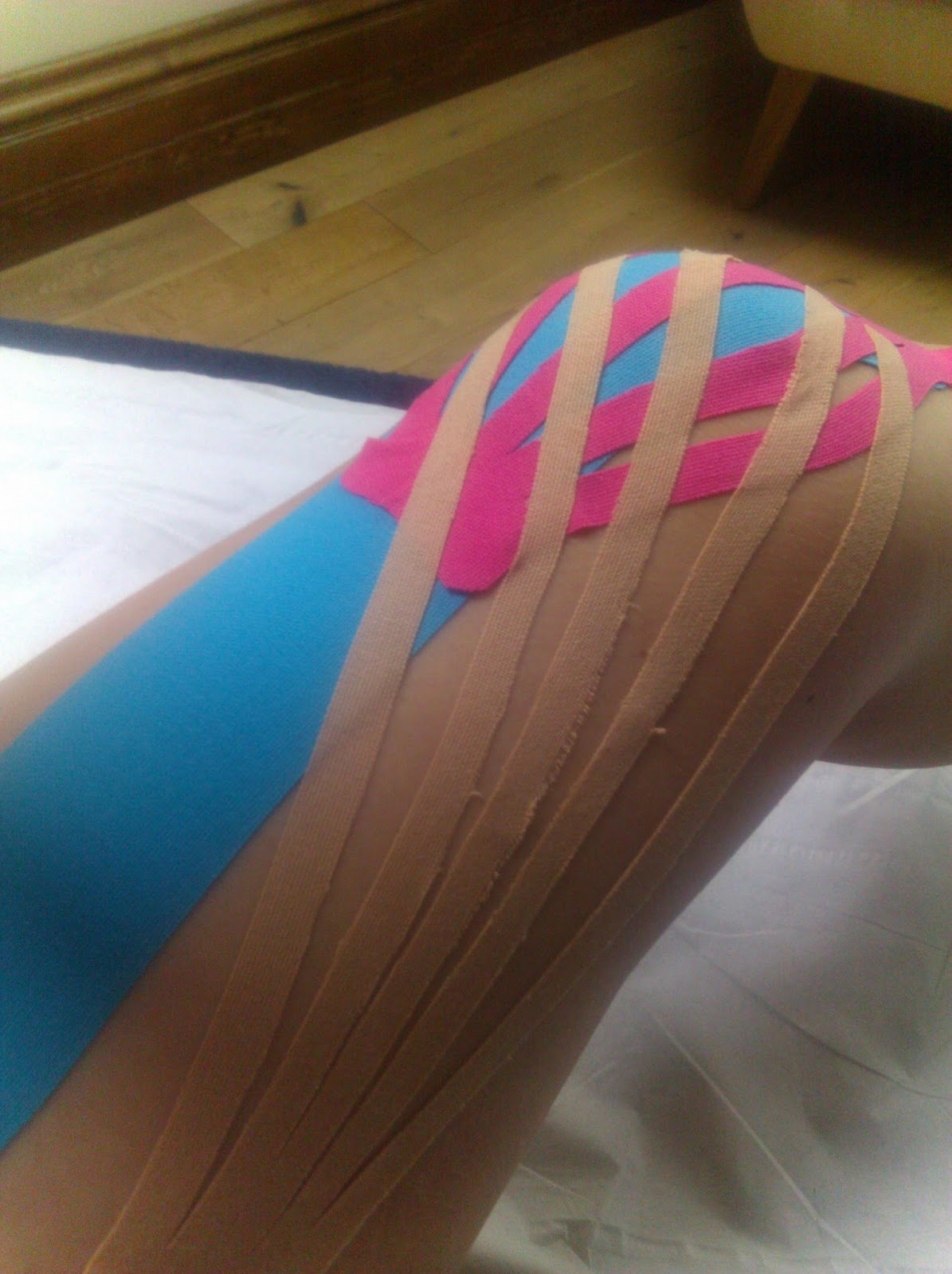 PAMO FIT Case Study The use of Kinesio Tape as part of an Integrated