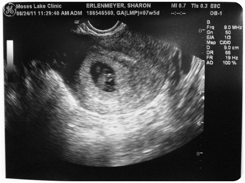 Healthy+heartbeat+at+6+weeks