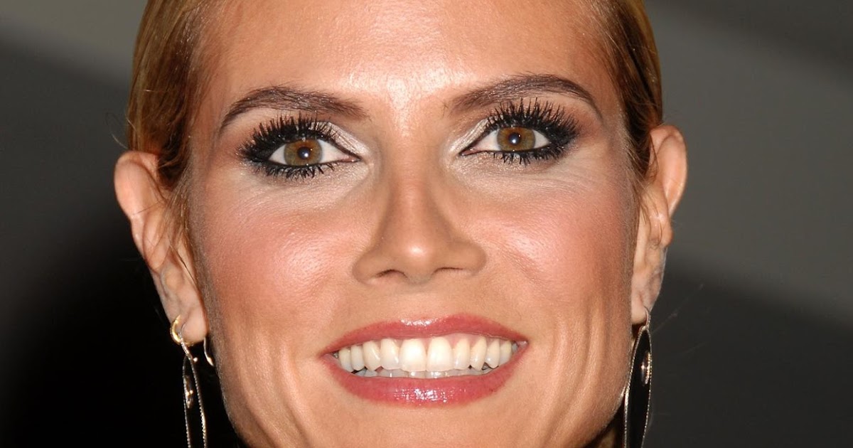 klum implants