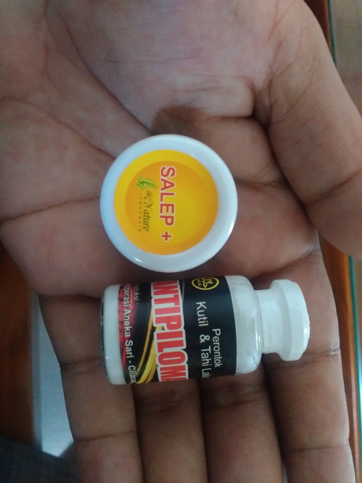 cuka apel untuk obat kutil kelamin