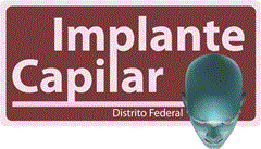 Implante Capilar DF. Ligue: 61 33611644