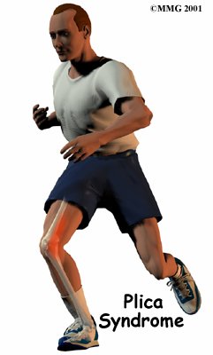 Pica Knee