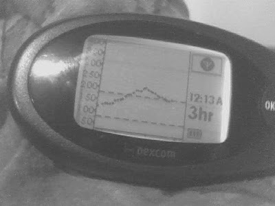 Picture of Dexcom three hour view with previous few readings missing and an out of range signal