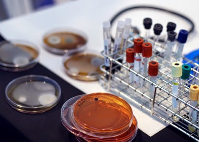 Reveal Completely about Genital Herpes Test