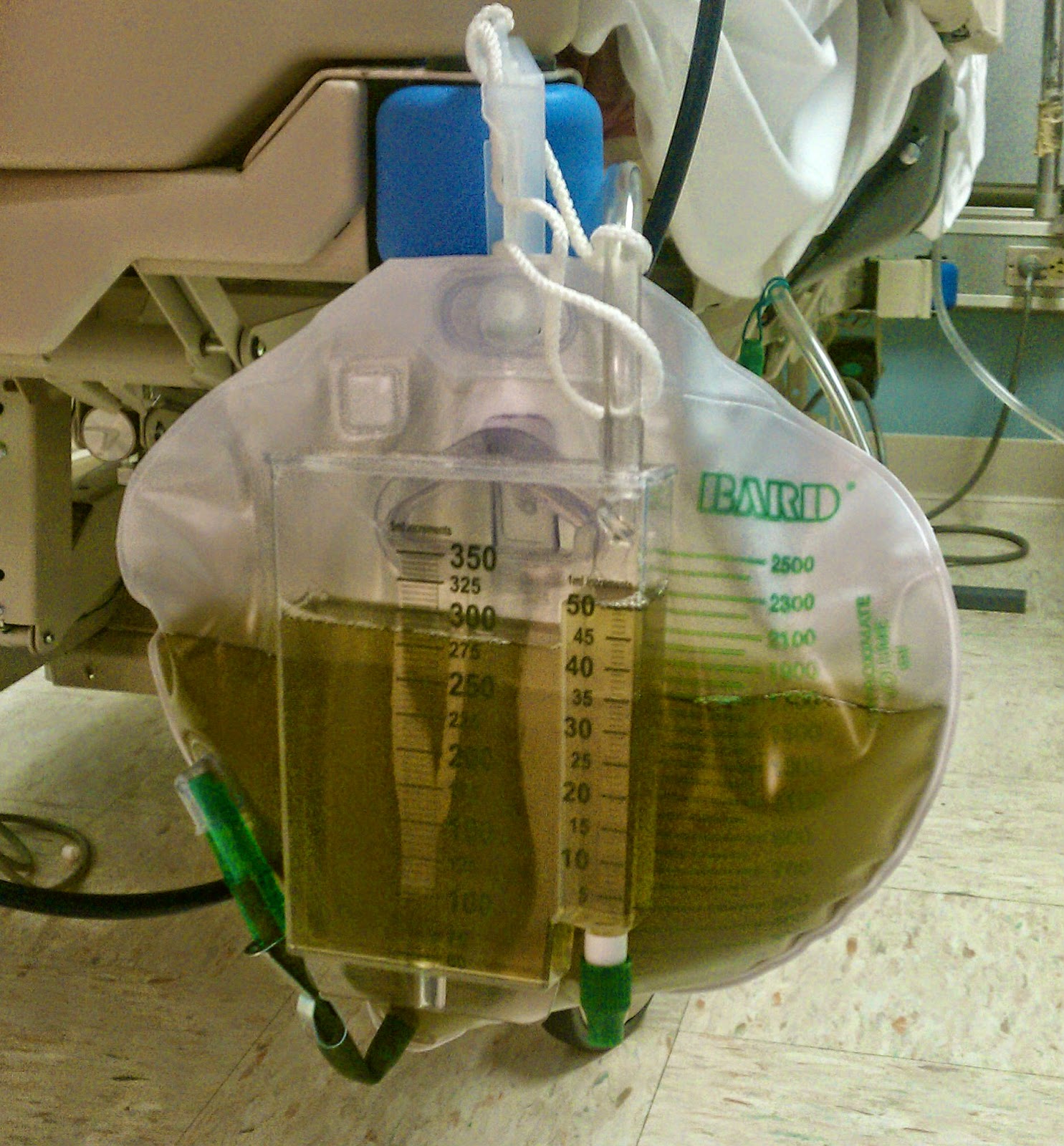 Bladder Spasms Medication Turns Urine Blue