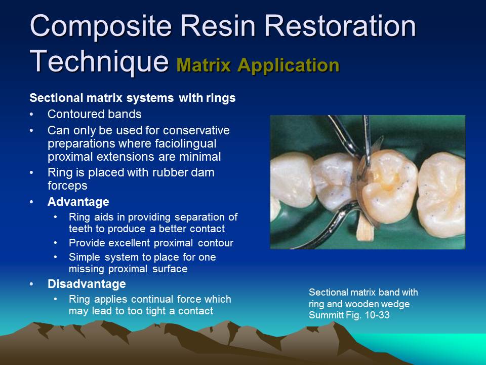 Dentistry Composite Resin
