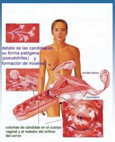 El hongo sobre las uñas de las manos de la bañera