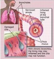 RESPIRATORY DISEASES RESPIRATORY DISEASES