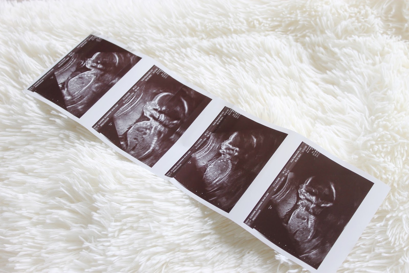 20 week scan photo, anomaly scan, it's a boy, 20 week scan boy, 