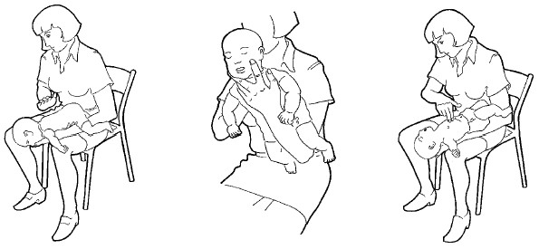 Osteokhondroz le traitement comme dormir