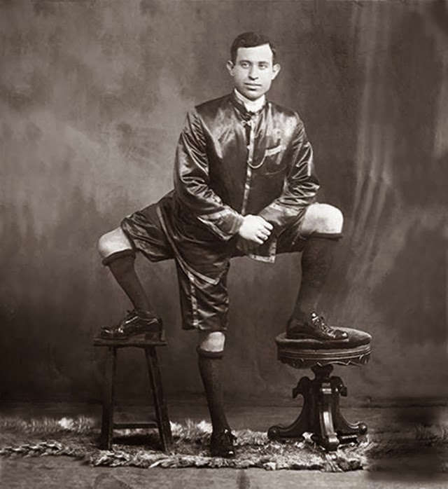 The Man With Three Legs Lentini Unbelievable Info
