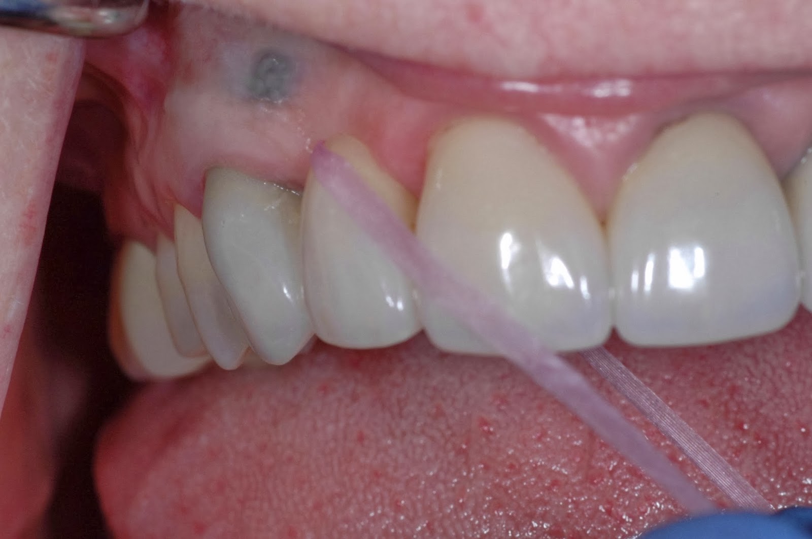 The Buzz from Your Favorite Dental Hygienists Hygiene Basics Floss a