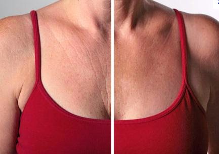 Die Maske für die Person die lebendige Maske des Fotos