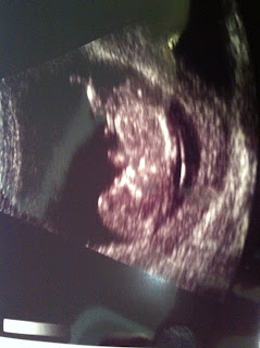 Baby Reinhard