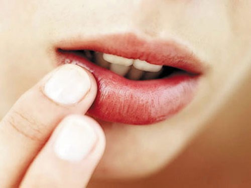 Mẹo làm cho môi không bị khô nẻ vào mùa đông Mẹo làm cho môi không bị khô nẻ vào mùa đông