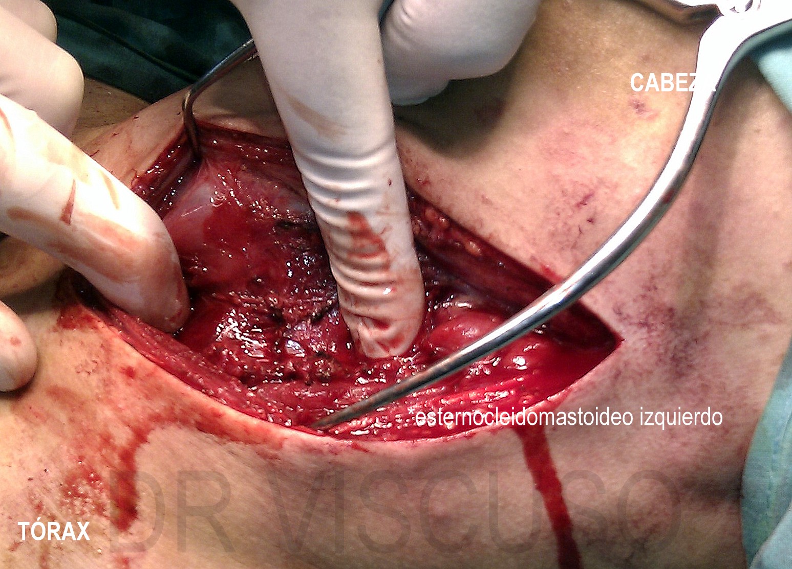 LESIONES DEDO lesiones dedo: