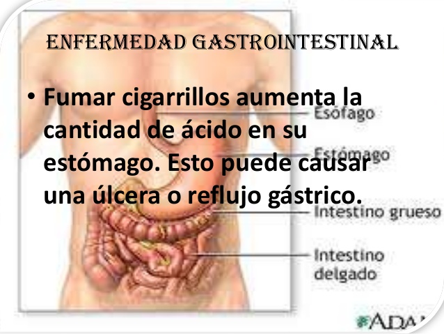 enfermedad gastrointestinal