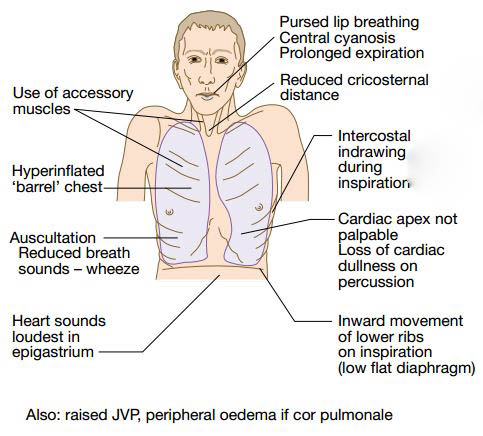 use of accessory muscles use of accessory muscles
