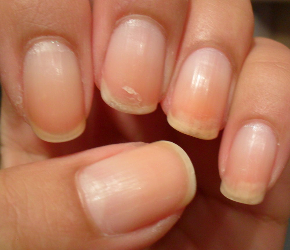 Ash Lilly S Lacquer My Nail Growth Progress 10th April