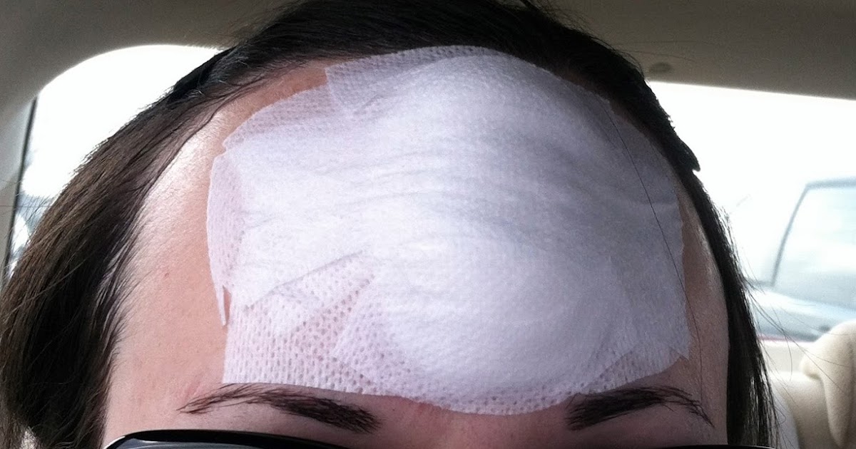 mary.berry Mohs Surgery Recovery Day 1