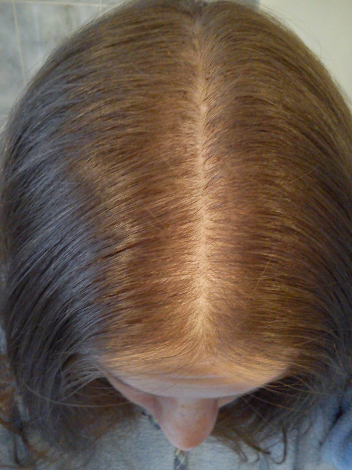Les rappels sur le shampooing clear la protection contre la chute des cheveux