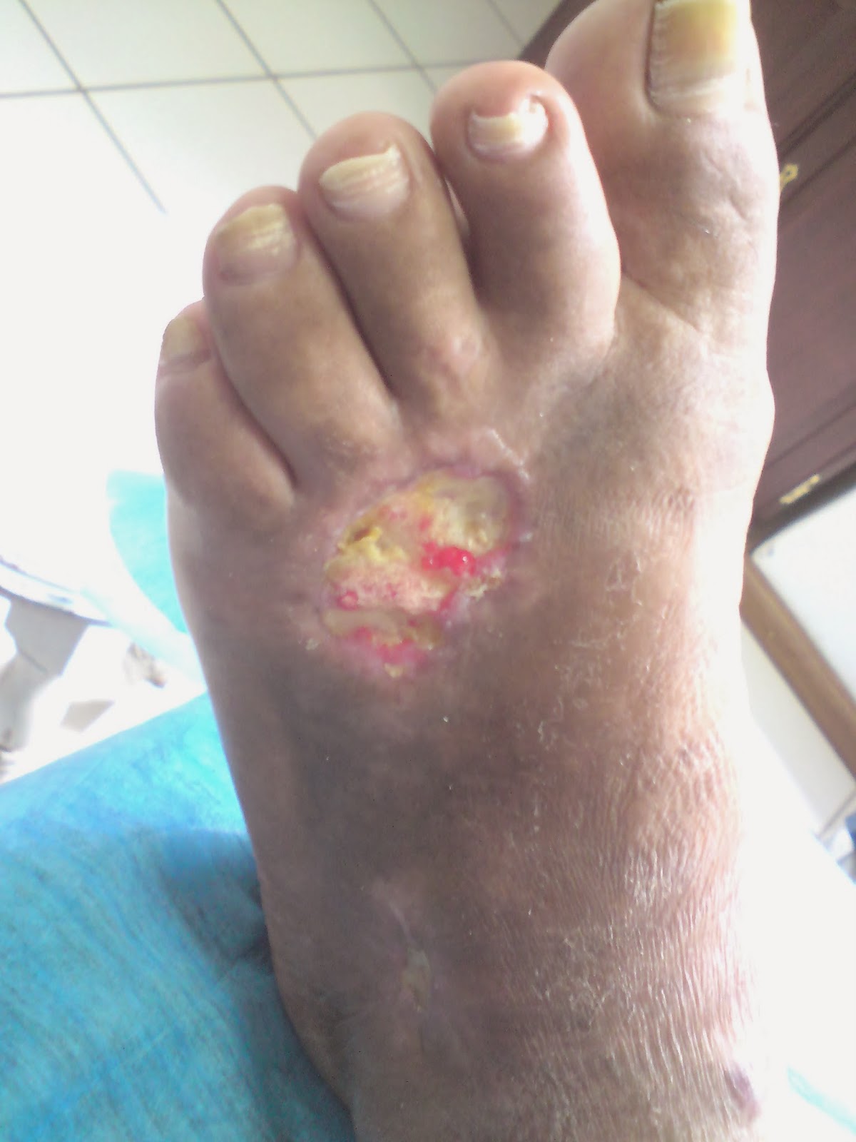De la cirugía vascular en ufe