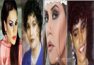 صور الفنانات قبل وبعد عمليات التجميل صور الفنانات قبل وبعد عمليات التجميل