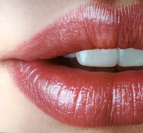 cracked bleeding lips