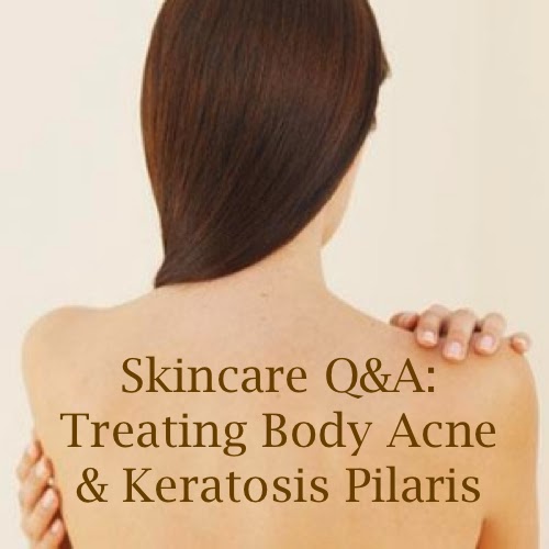 The Acne Whisperer Skincare Q&A Salvaging Your Skin From Body Acne