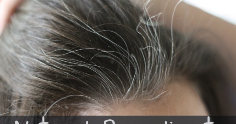 Easy Home Remedies Natural Remedies To Get Rid Of White Hair Forever