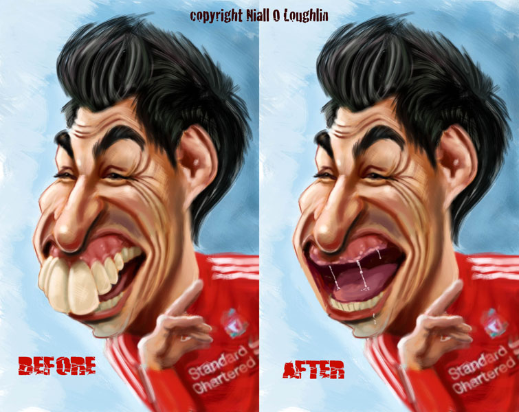 Luis-Suarez-bite.jpg