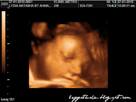 ♥our lil junior♥