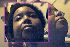 Angelika's Bells Palsy