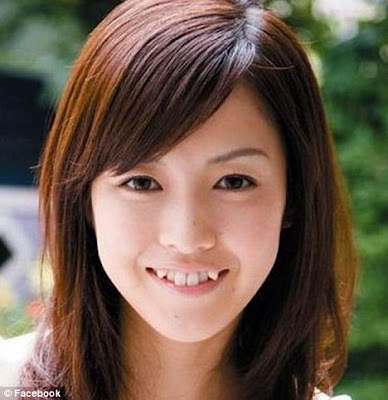 Gigi taring berlapis jadi kegilaan wanita Jepun