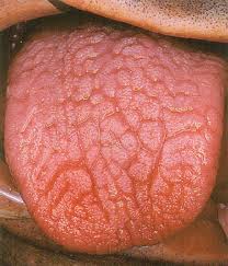 SEMIOLOGIA DE HOY: TIPOS DE LENGUA SEMIOLOGIA DE HOY: TIPOS DE LENGUA