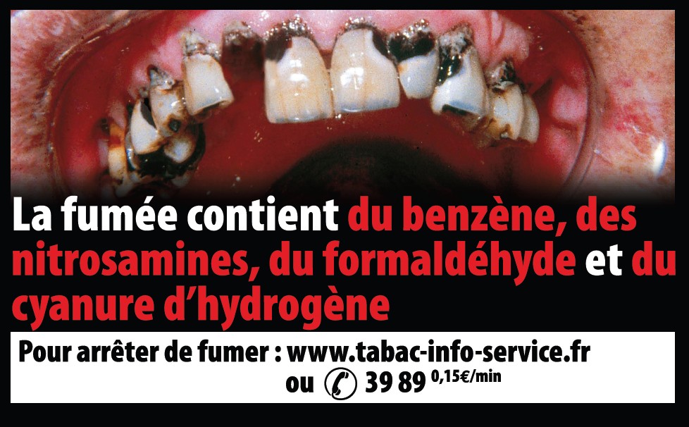 Si cesser de fumer rudement les conséquences que faire