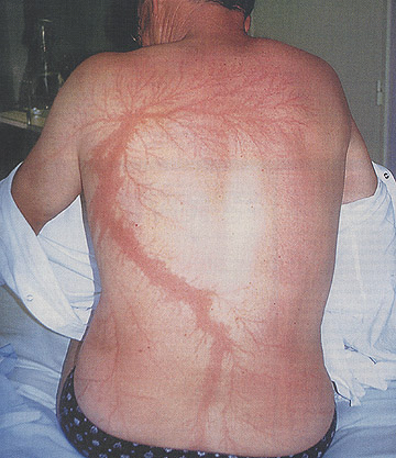Henna Tattoos Boston on Laser And Cosmetic Center At Boston S Massachusetts General Hospital