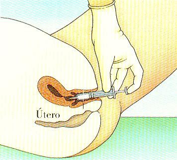 Inseminação Inseminação Artificial