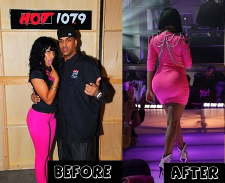 Nicki Minaj Before And After The Surgery Nicki Minaj Before And After The Surgery