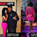 Nicki Minaj Before And After Plastic Surgery