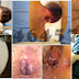 Obat Salep Wasir Ambeven Pria dan Wanita thumbnail
